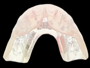 , Mouthguards