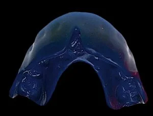 , Mouthguards