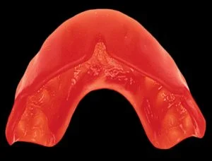 , Mouthguards